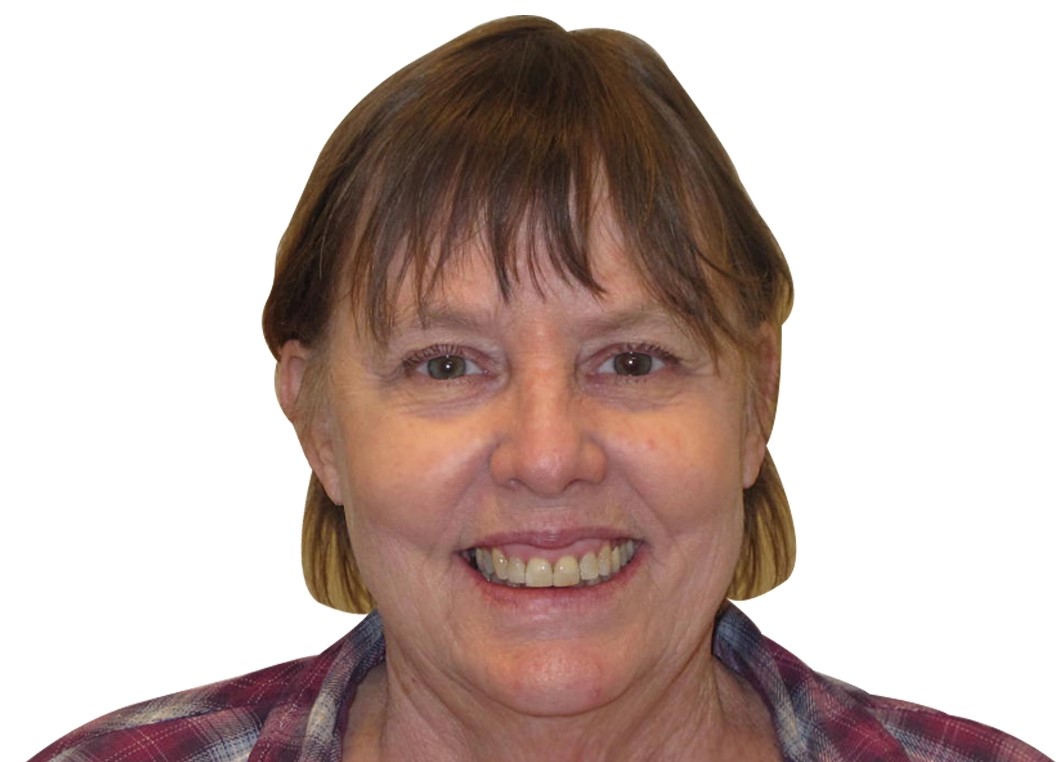 Patient 3 smile after treatment