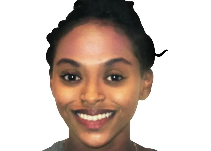 Patient 4 smile after treatment