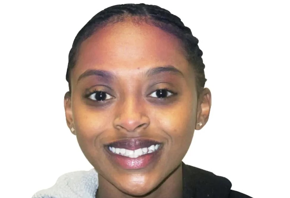 Patient 4 smile before treatment